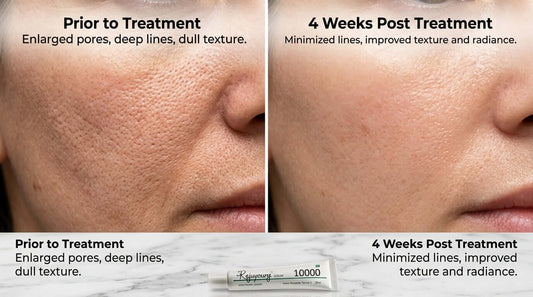 Don’t Try Vitna Juvelook 10,000 Unless You’re Looking for Serious Skin Bounce