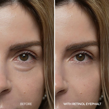 Dr. Melaxin EYEPHALT Retinol Eyebag Cream