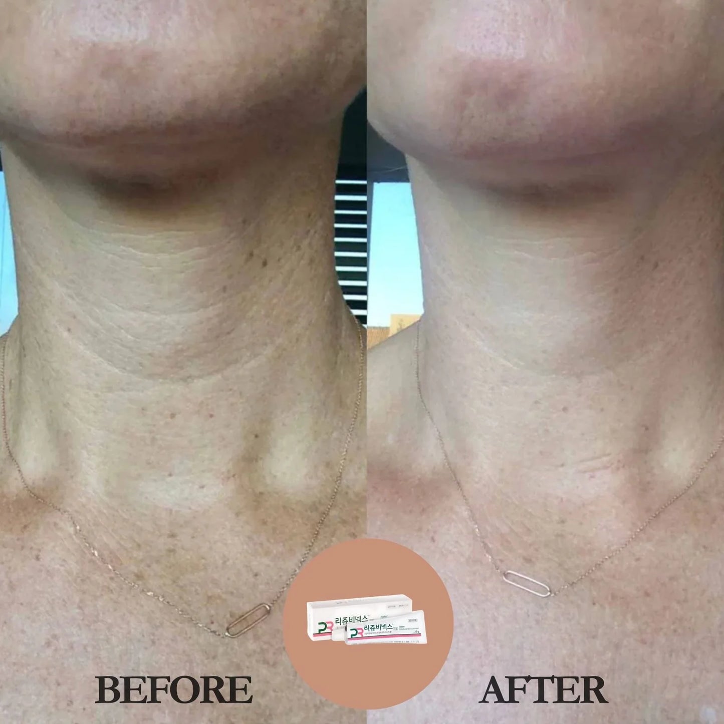 RejuvenX PDRN Cream